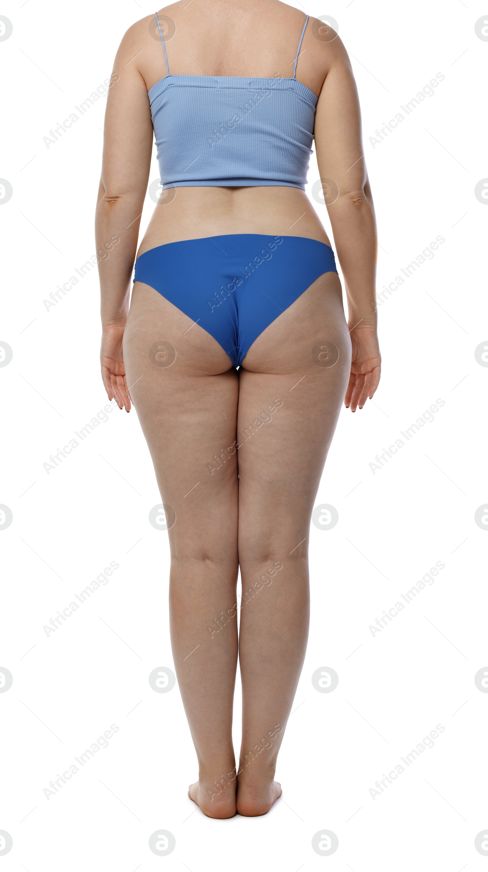 Photo of Liposuction. Woman in underwear on white background, back view