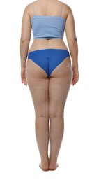 Photo of Liposuction. Woman in underwear on white background, back view