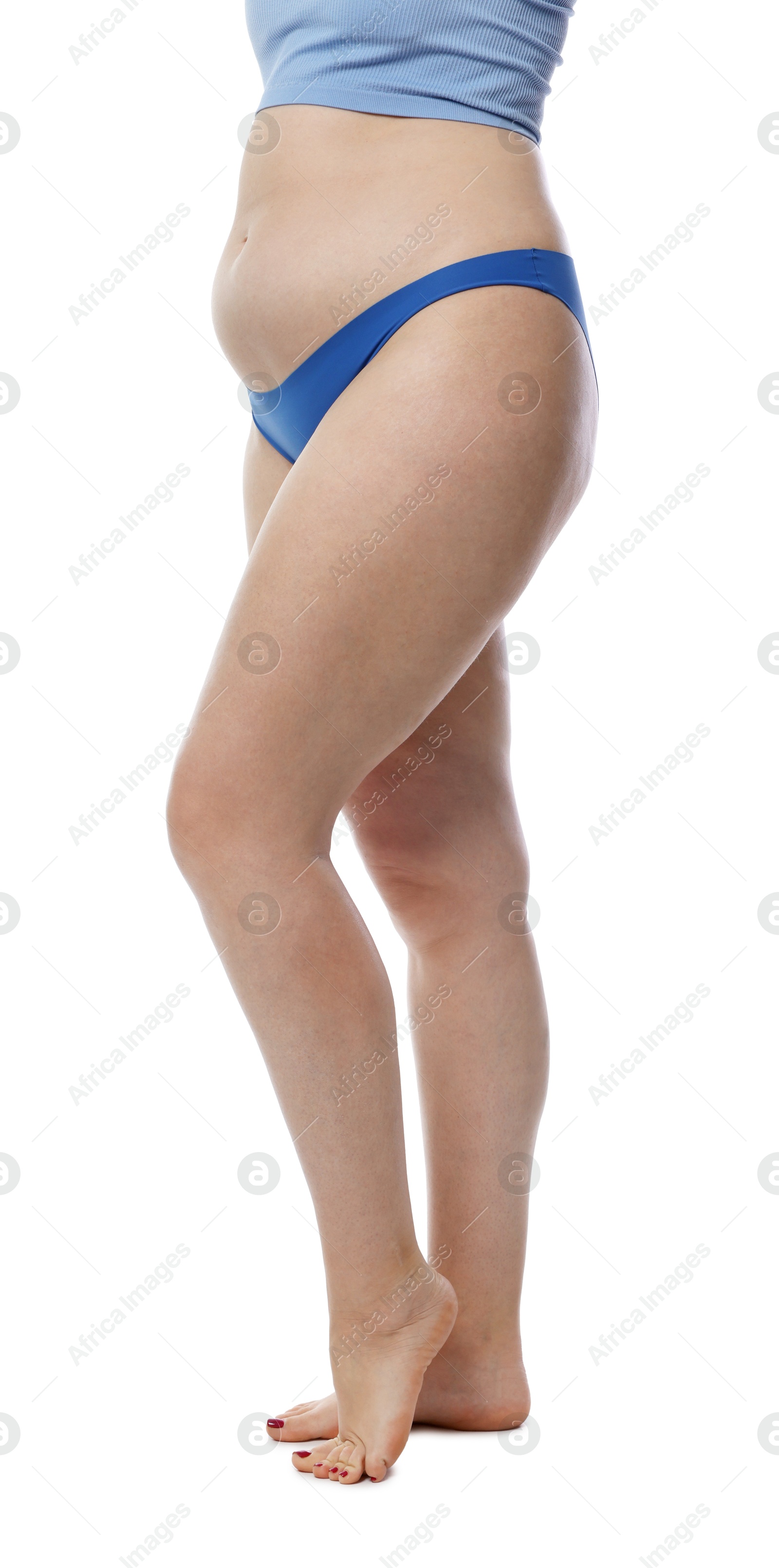 Photo of Liposuction. Woman in underwear on white background, closeup