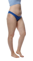 Photo of Liposuction. Woman in underwear on white background, closeup