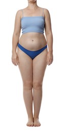 Photo of Liposuction. Woman in underwear on white background, closeup