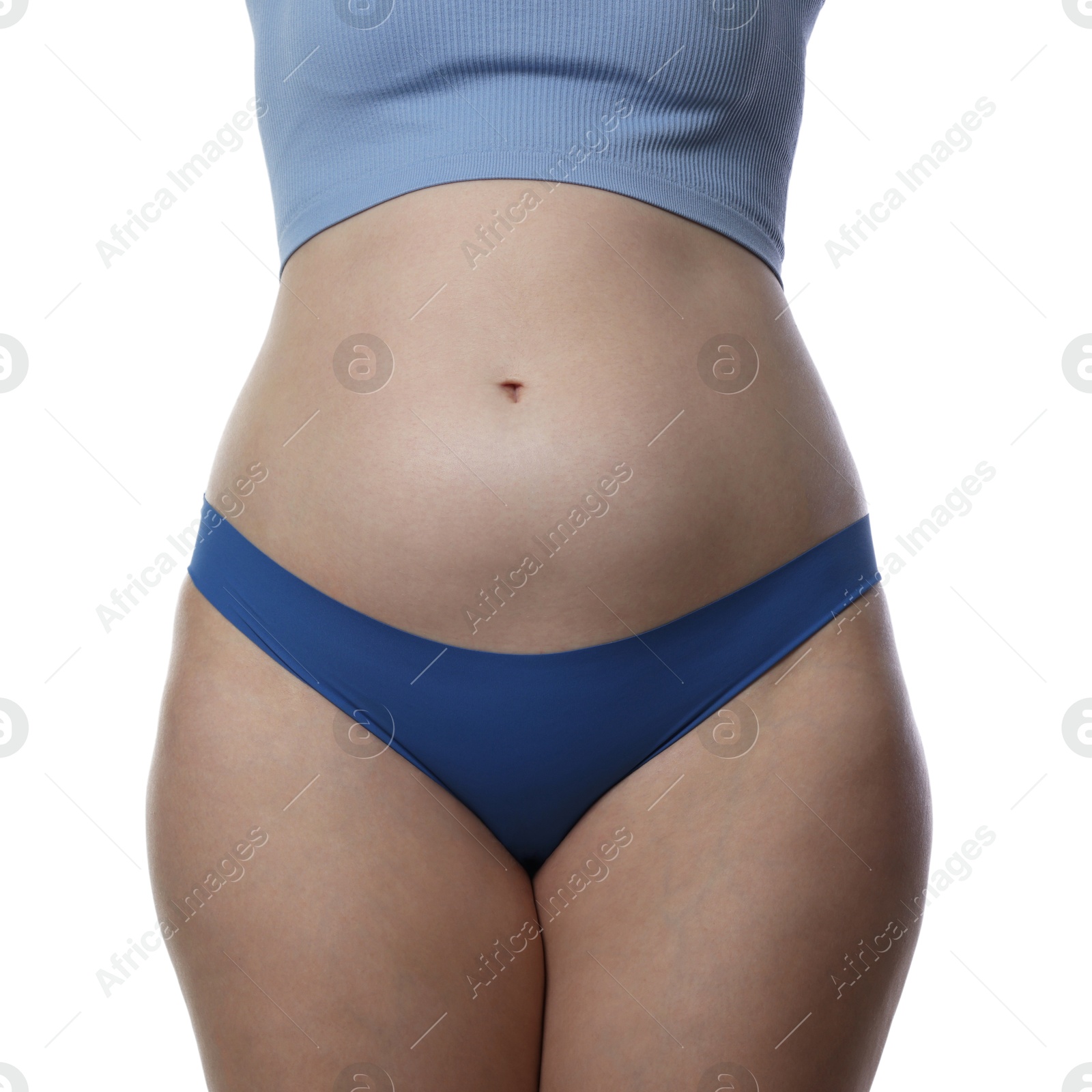 Photo of Liposuction. Woman in underwear on white background, closeup