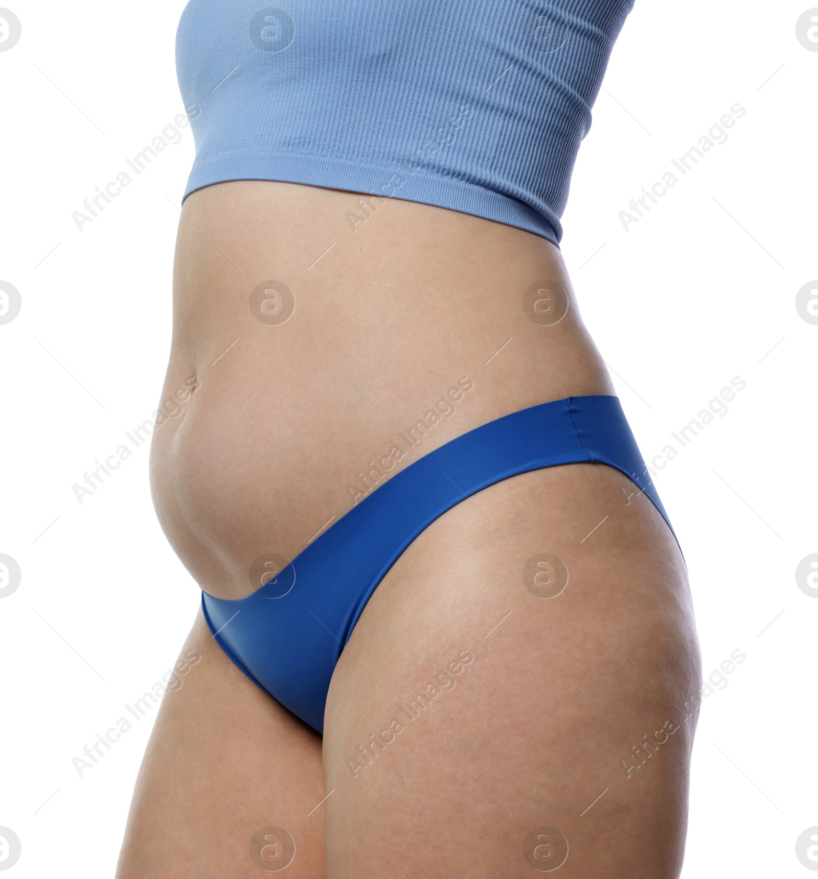 Photo of Liposuction. Woman in underwear on white background, closeup
