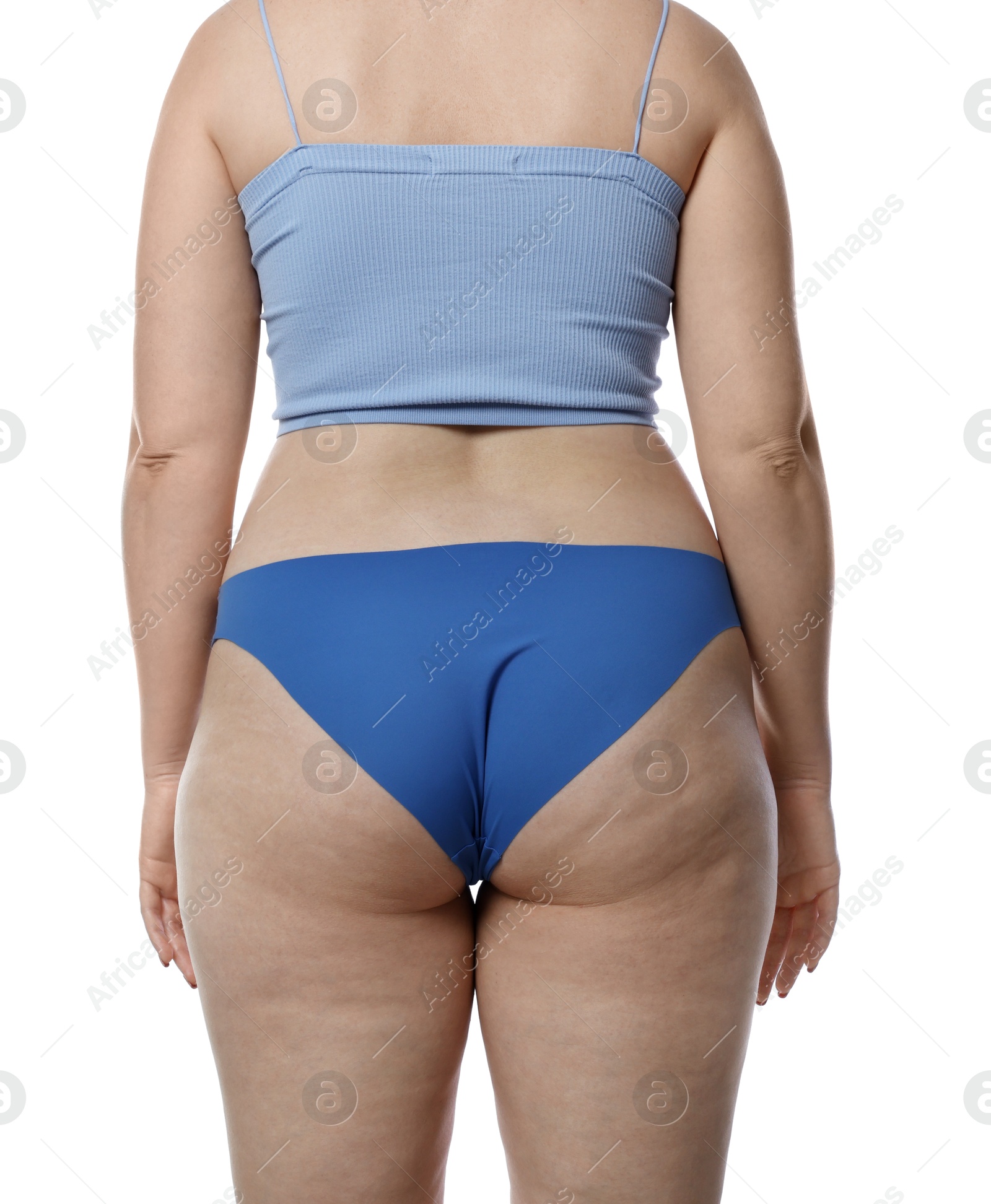 Photo of Liposuction. Woman in underwear on white background, back view