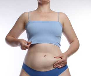 Photo of Liposuction. Woman in underwear touching her belly on white background, closeup