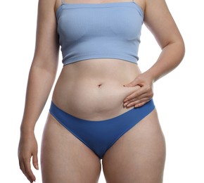 Photo of Liposuction. Woman in underwear touching her belly on white background, closeup