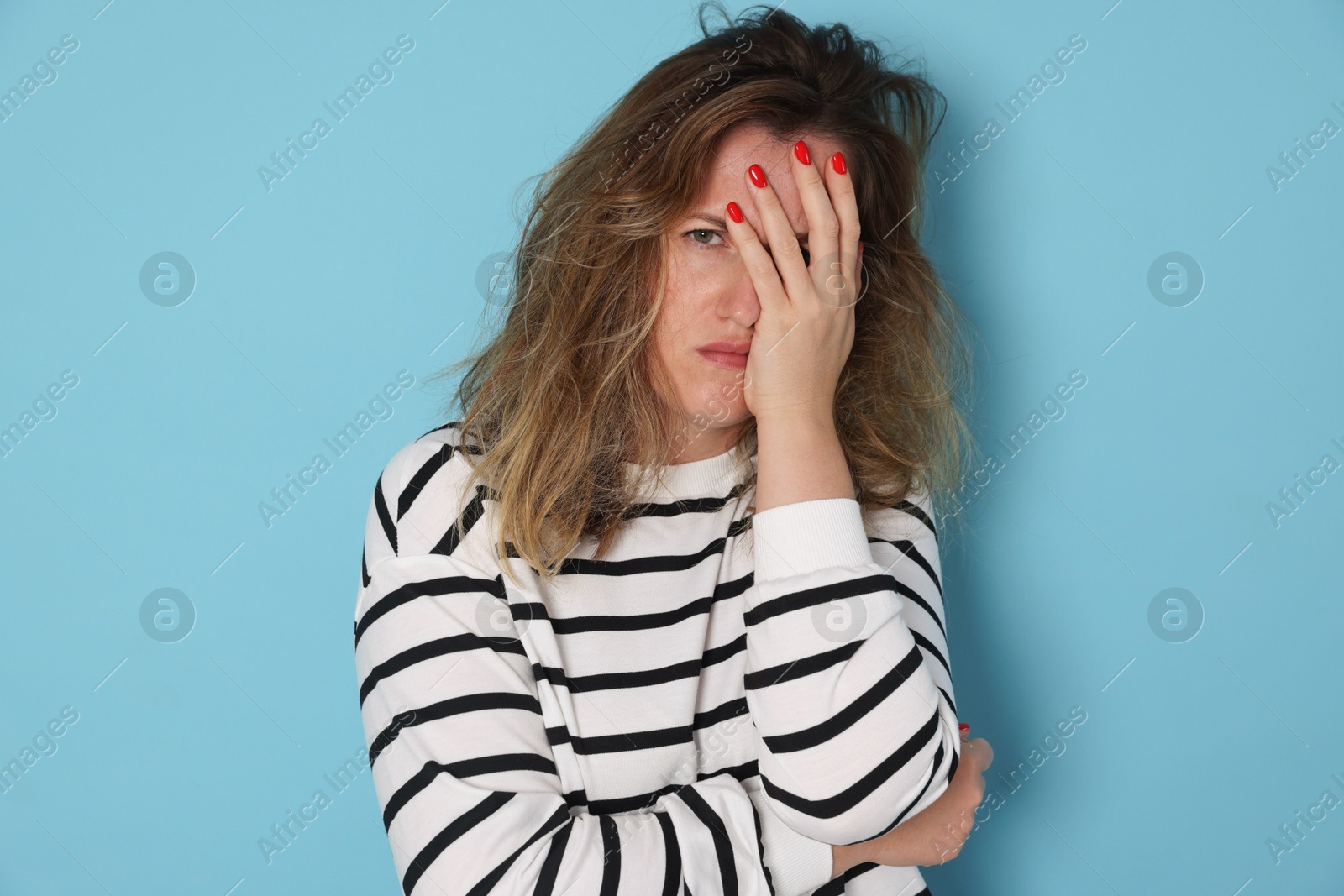 Photo of Woman suffering from hangover on light blue background