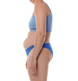 Photo of Woman with bad posture on white background, closeup