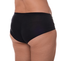 Photo of Woman in underwear before weight loss on white background, closeup