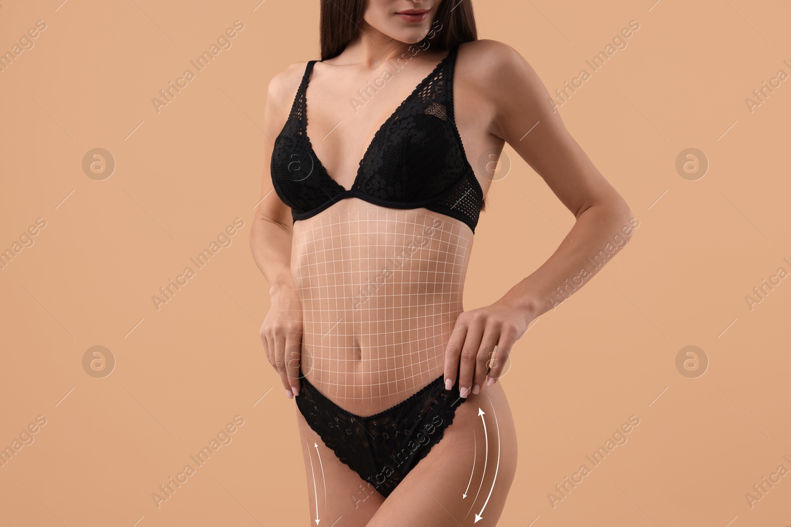 Image of Liposuction. Woman with perfect figure against dark beige background, closeup. Markings on her body