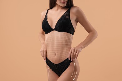 Image of Liposuction. Woman with perfect figure against dark beige background, closeup. Markings on her body