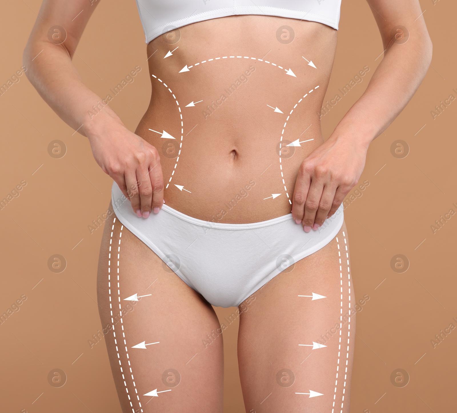 Liposuction. Woman with perfect figure against dark beige background, closeup. Markings on her body Image of Liposuction. Woman with perfect figure against dark beige background, closeup. Markings on her body