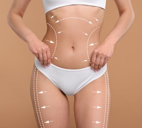 Image of Liposuction. Woman with perfect figure against dark beige background, closeup. Markings on her body