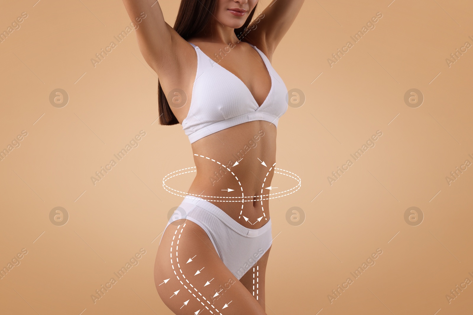 Liposuction. Woman with perfect figure against dark beige background, closeup. Markings on her body Image of Liposuction. Woman with perfect figure against dark beige background, closeup. Markings on her body