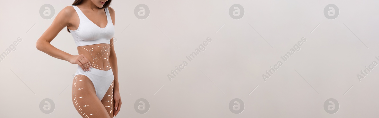 Image of Liposuction. Woman with perfect figure against light background, closeup. Markings on her body