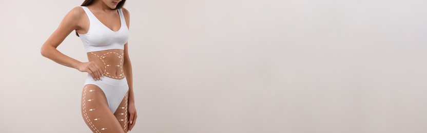 Image of Liposuction. Woman with perfect figure against light background, closeup. Markings on her body