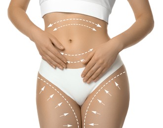 Image of Liposuction. Woman with perfect figure against white background, closeup. Markings on her body