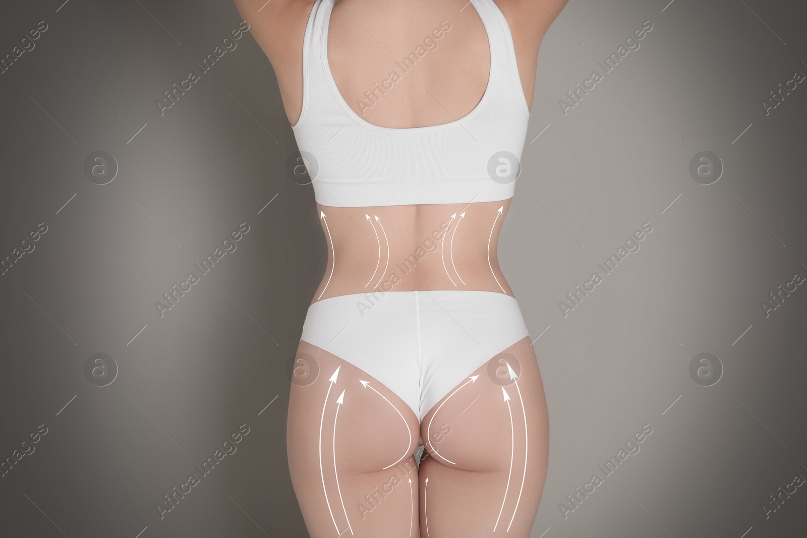 Image of Liposuction. Woman with perfect figure against grey gradient background, closeup. Markings on her body