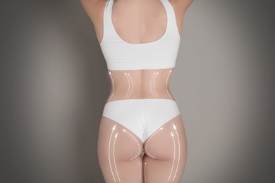 Image of Liposuction. Woman with perfect figure against grey gradient background, closeup. Markings on her body