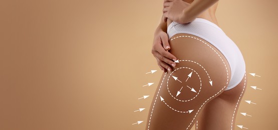 Image of Liposuction. Woman with perfect figure against dark beige background, closeup. Markings on her body