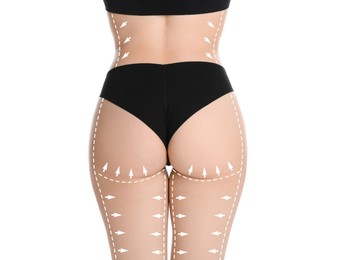 Image of Liposuction. Woman with perfect figure against white background, closeup. Markings on her body