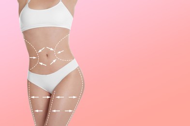 Image of Liposuction. Woman with perfect figure against pink gradient background, closeup. Markings on her body