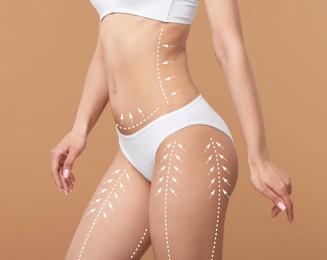 Image of Liposuction. Woman with perfect figure against dark beige background, closeup. Markings on her body