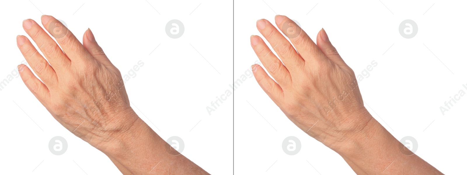 Image of Ageing skin. Woman's hand on white background, closeup. Collage showing difference in texture