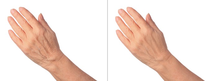 Image of Ageing skin. Woman's hand on white background, closeup. Collage showing difference in texture