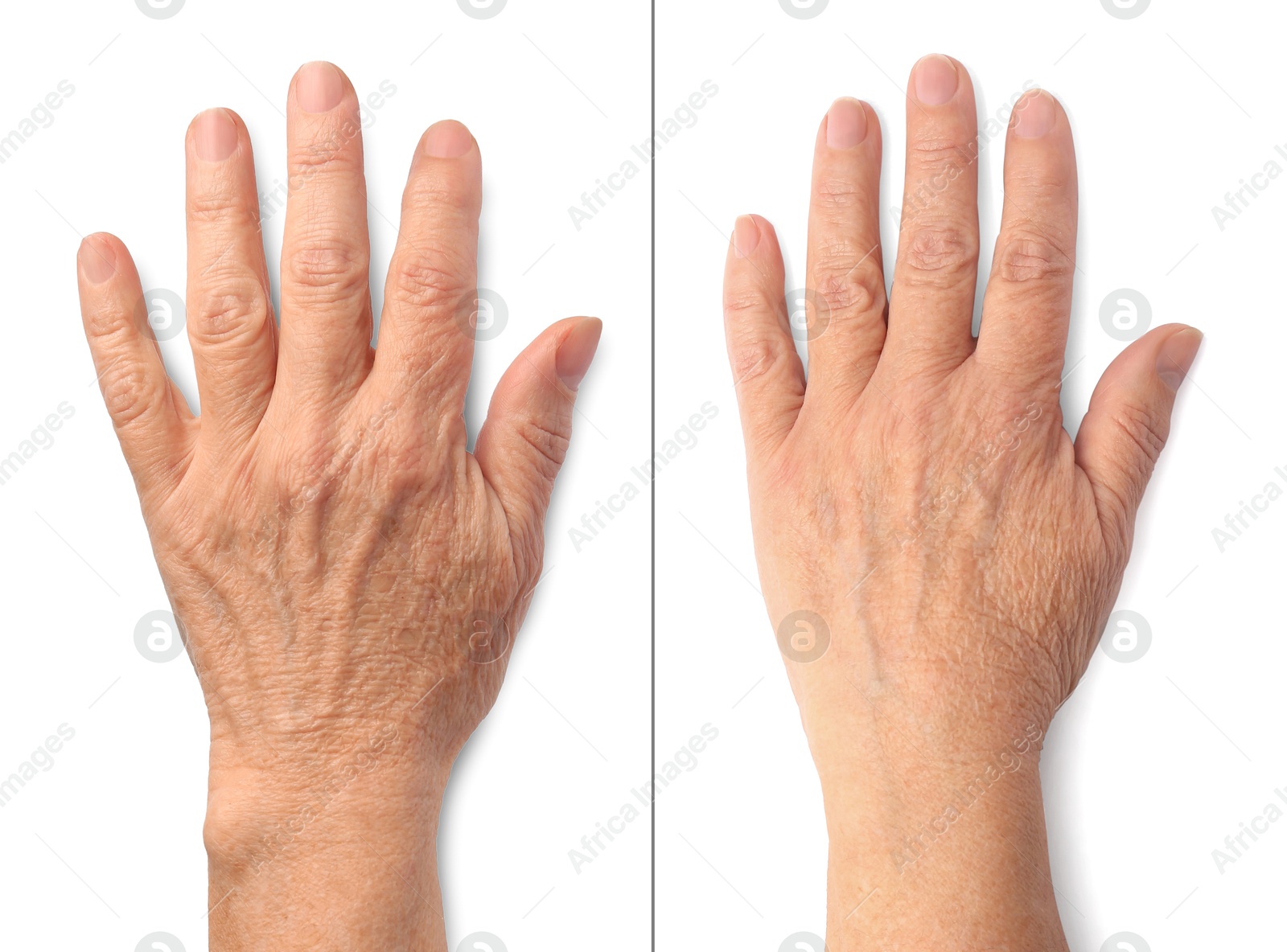 Image of Ageing skin. Woman's hand on white background, closeup. Collage showing difference in texture