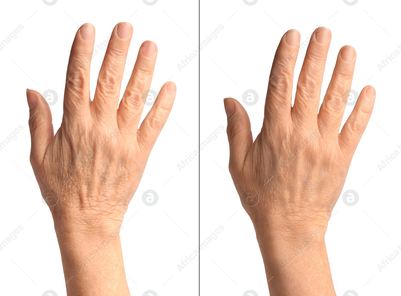 Ageing skin. Woman's hand on white background, closeup. Collage showing difference in texture Image of Ageing skin. Woman's hand on white background, closeup. Collage showing difference in texture