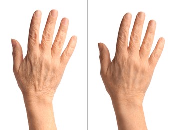 Image of Ageing skin. Woman's hand on white background, closeup. Collage showing difference in texture