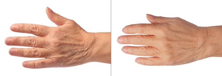 Image of Ageing skin. Woman's hand on white background, closeup. Collage showing difference in texture
