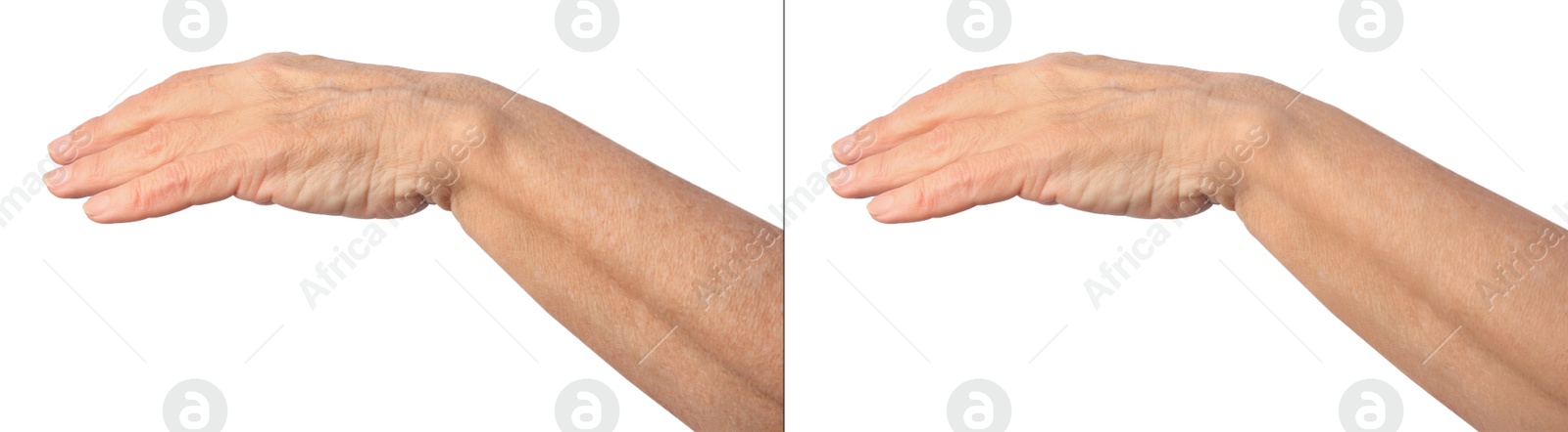 Image of Ageing skin. Woman's hand on white background, closeup. Collage showing difference in texture