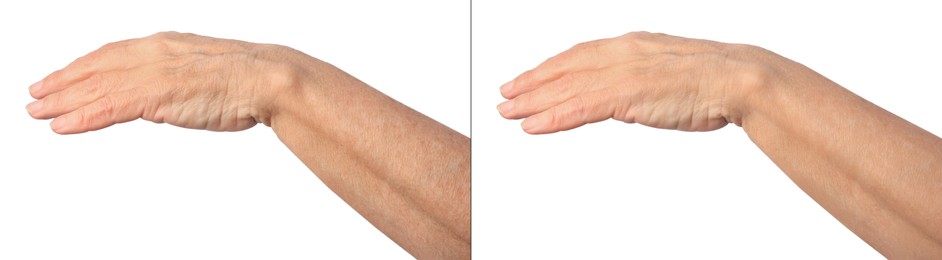 Image of Ageing skin. Woman's hand on white background, closeup. Collage showing difference in texture