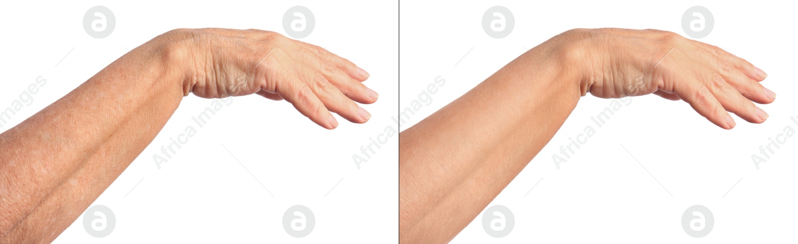 Image of Ageing skin. Woman's hand on white background, closeup. Collage showing difference in texture