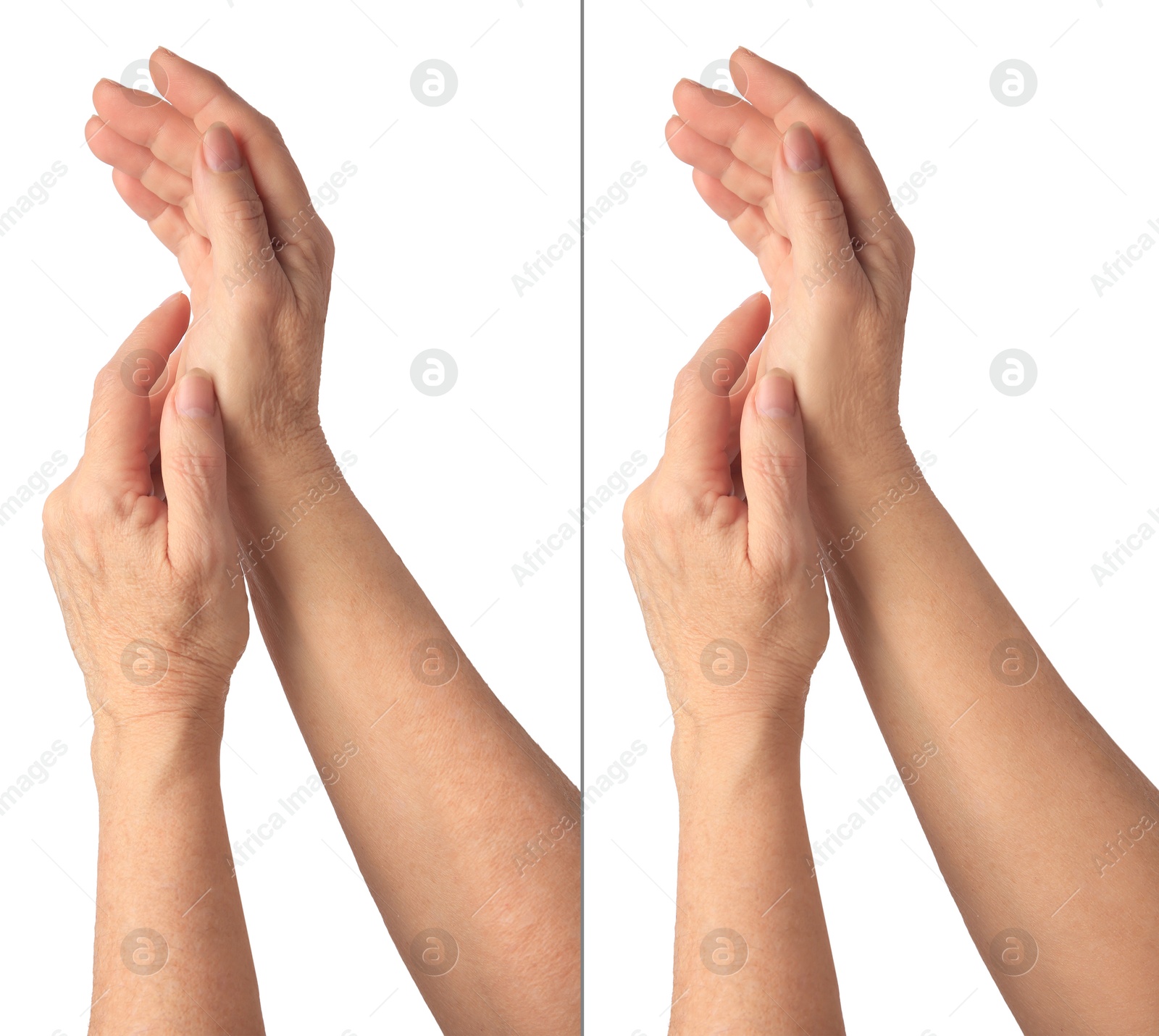 Image of Ageing skin. Woman's hands on white background, closeup. Collage showing difference in texture