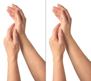 Image of Ageing skin. Woman's hands on white background, closeup. Collage showing difference in texture
