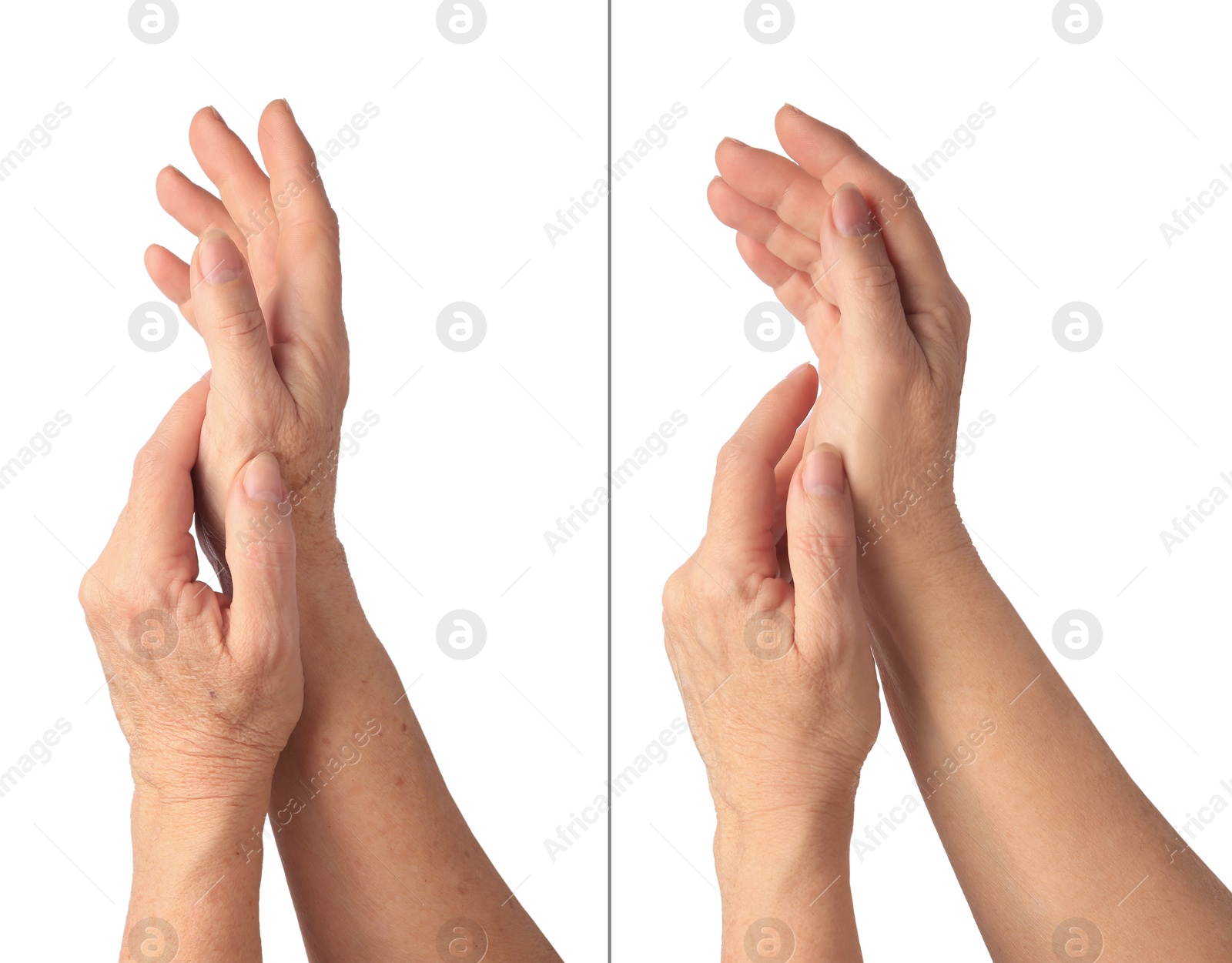 Image of Ageing skin. Woman's hands on white background, closeup. Collage showing difference in texture