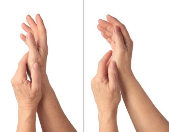 Image of Ageing skin. Woman's hands on white background, closeup. Collage showing difference in texture