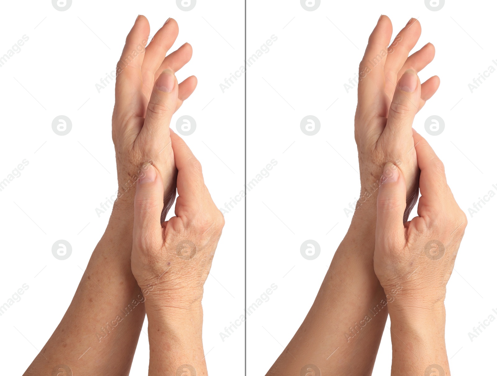 Image of Ageing skin. Woman's hands on white background, closeup. Collage showing difference in texture