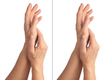 Image of Ageing skin. Woman's hands on white background, closeup. Collage showing difference in texture
