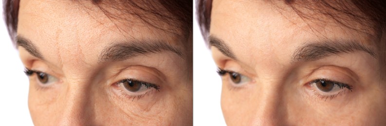 Image of Ageing. Photos of woman's face, closeup. Collage showing difference in skin texture