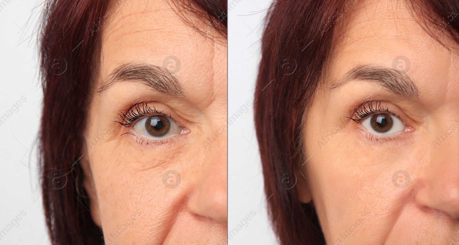 Image of Ageing. Photos of woman's face, closeup. Collage showing difference in skin texture