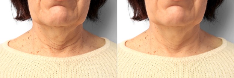 Image of Ageing. Photos of woman's neck, closeup. Collage showing difference in skin texture