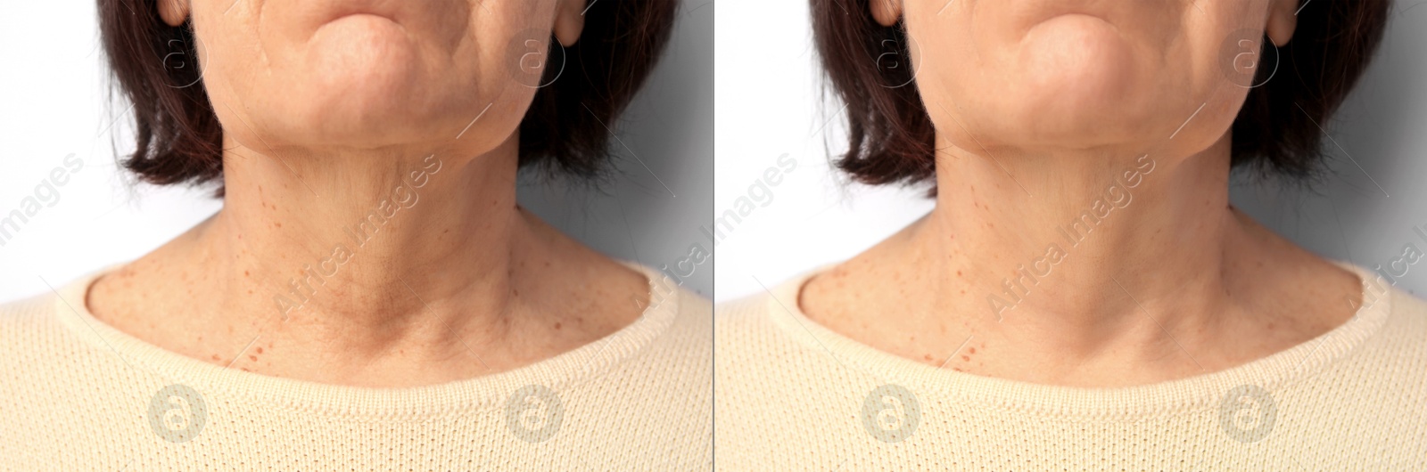 Image of Ageing. Photos of woman's neck, closeup. Collage showing difference in skin texture