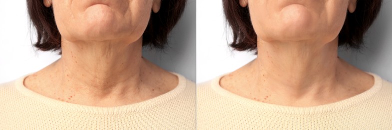 Image of Ageing. Photos of woman's neck, closeup. Collage showing difference in skin texture