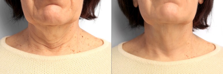 Image of Ageing. Photos of woman's neck, closeup. Collage showing difference in skin texture