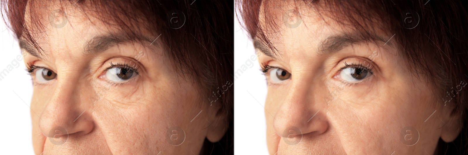 Image of Ageing. Photos of woman's face, closeup. Collage showing difference in skin texture