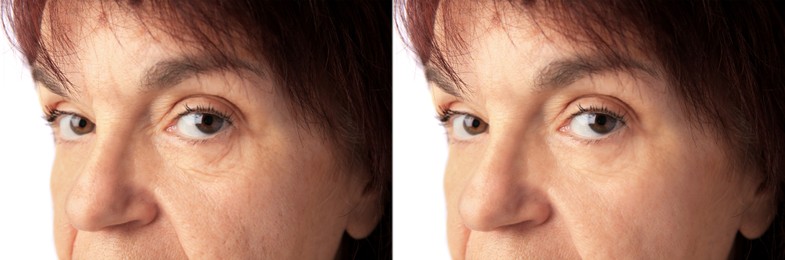 Image of Ageing. Photos of woman's face, closeup. Collage showing difference in skin texture